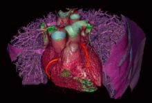https://www.sante-decouverte.com/wp-content/uploads/imgsd/malaises-lipothymie-syncope-maux-et-mots-du-coeur_s.jpg